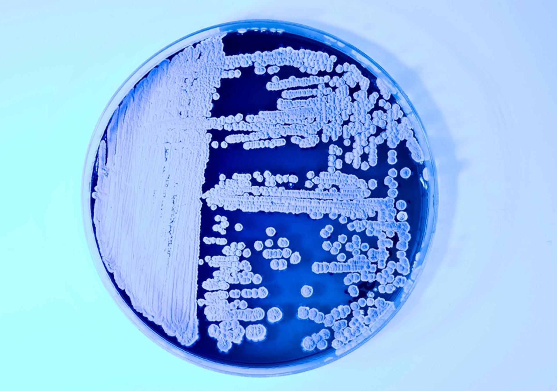 Petri dish with various microbial colonies showcasing biodesign and sustainable materials research by Natsai Audrey Chieza.